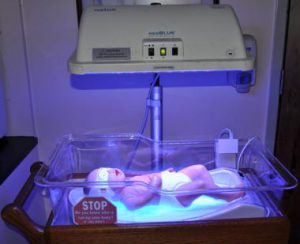 اجاره دستگاه درمان زردی نوزاد-کلاب رنتر